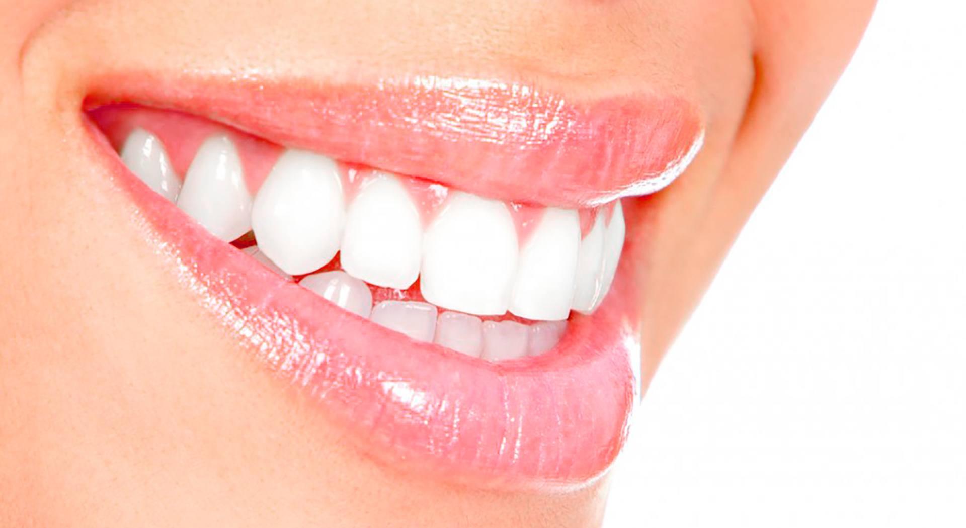 Ivory Teeth Whitening Edmonton