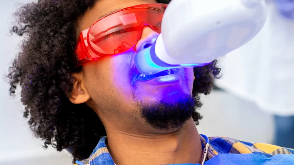 laser teeth whitening for your sensitive teeth